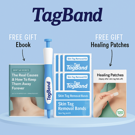 Auto TagBand® - Skin Tag Removal Kit